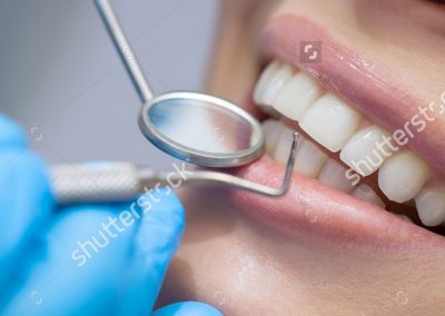 stock-photo-dentist-examining-a-patient-s-teeth-in-the-dentist-364820015