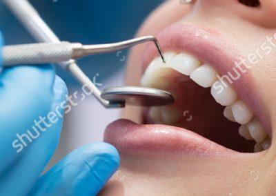 stock-photo-dentist-examining-a-patient-s-teeth-in-the-dentist-364820018